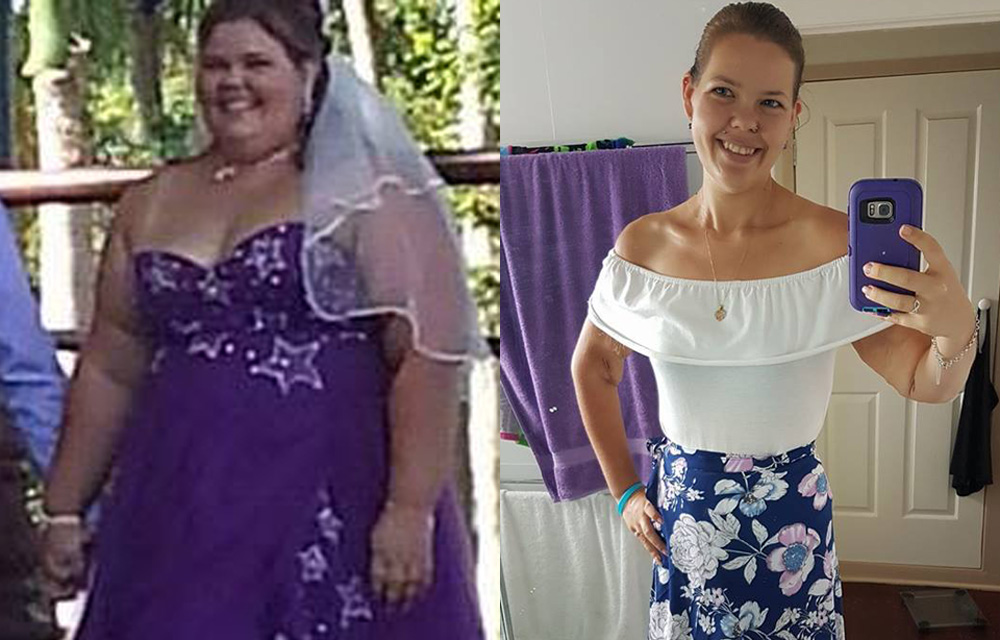 Mother Loses 52 Kilos In A Year New Idea